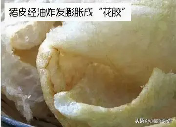 有甲状腺结节能吃鱼胶吗()